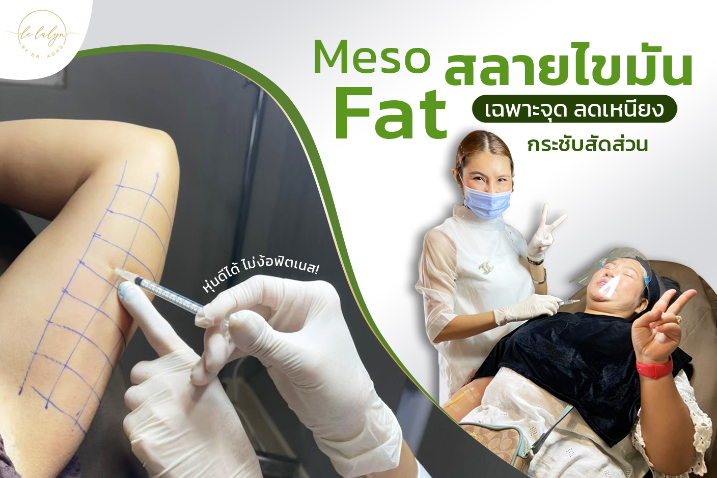 Meso fat  สลายไขมันเฉพาะจุด ลดเหนียง กระชับสัดส่วน หุ่นดีได้ ไม่ง้อฟิตเนส!